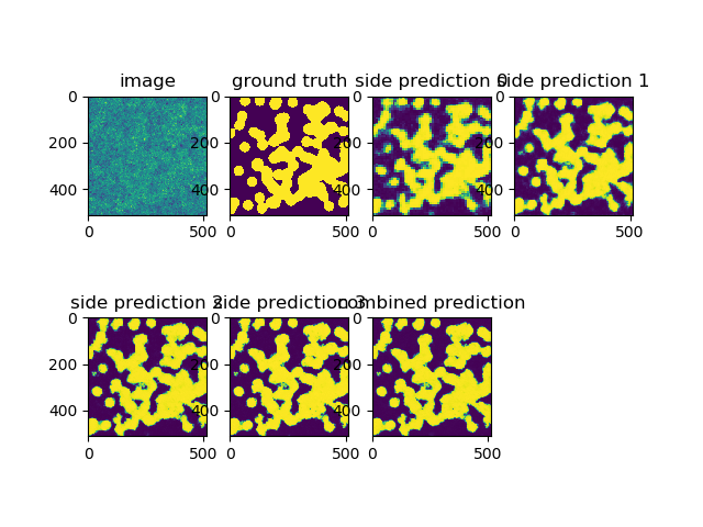 ../_images/sphx_glr_plot_train_side_loss_unet_001.png